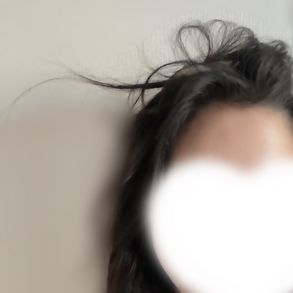 アップロード画像